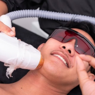 In einer Sitzung werden einem Mann die Barthaare mit einem Laser entfernt.