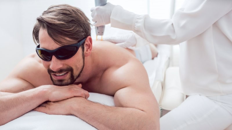 Einem Mann werden mit einem Laser die Rückenhaare entfernt.